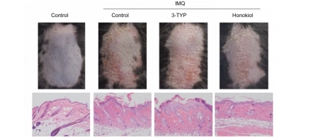 IMQ诱导下SIRT3调控银屑病样炎症机制图